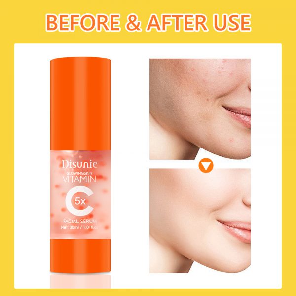 Vitamin C Face Serum – Brightening, Whitening, Anti-Aging with Hyaluronic Acid & Collagen - Image 2