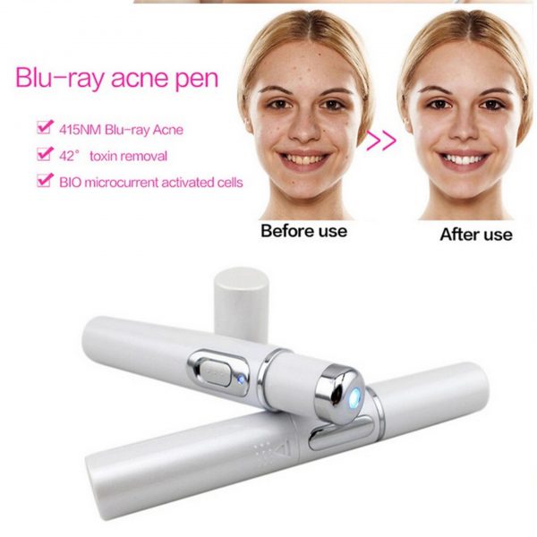 Acne Laser Pen with Blue Light Therapy – Gentle Scar & Wrinkle Removal Skin Care Device - Image 9