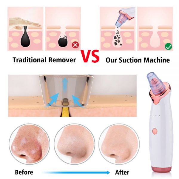 Blackhead Instrument Electric Suction Facial Washing Instrument Beauty Acne Cleaning Blackhead Suction Instrument - Image 9