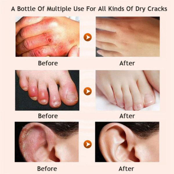 Honey moisturizing cream foot cream leg cream - Image 4