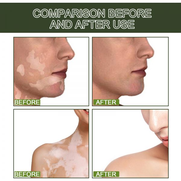 Whitening Skin Moisturizing Care Solution - Image 4