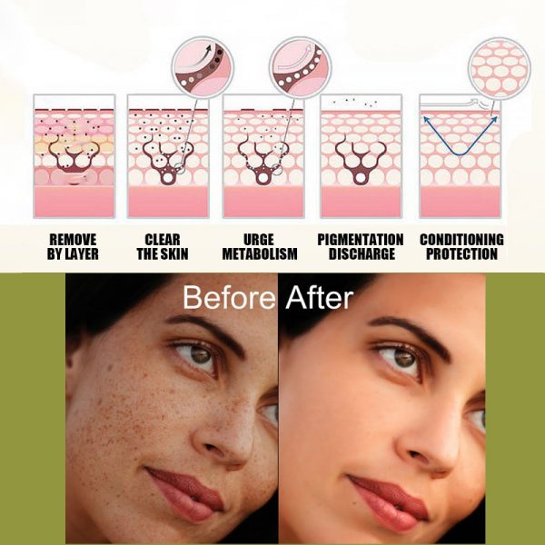 Fade Spot Repair Skin Dull Whitening Skin Lightening Cream - Image 5