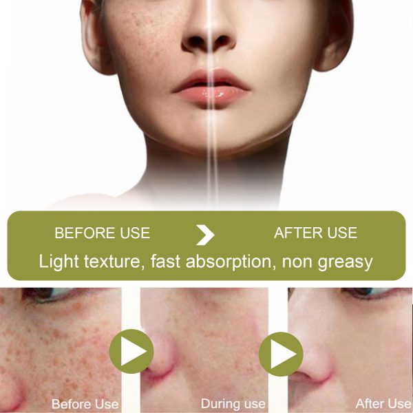 Fade Spot Repair Skin Dull Whitening Skin Lightening Cream - Image 10