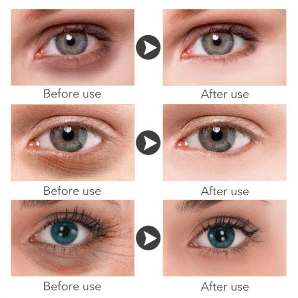 Beauty Eye Cream30mlwish Women's Skin Care Products - Image 6