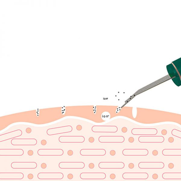 Ultrasonic Skin Rejuvenation Whitening Shoveling Machine Exfoliating Skin Care - Image 3