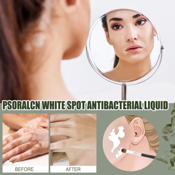 Whitening Skin Moisturizing Care Solution - Image 2