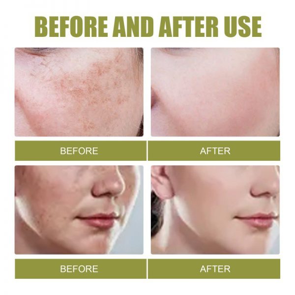 Fade Spot Repair Skin Dull Whitening Skin Lightening Cream - Image 4