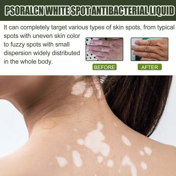 Whitening Skin Moisturizing Care Solution - Image 3