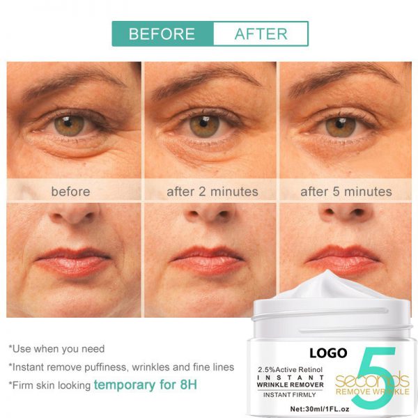 Hot Selling Skin Care Products Active Retinol Face Cream - Image 4