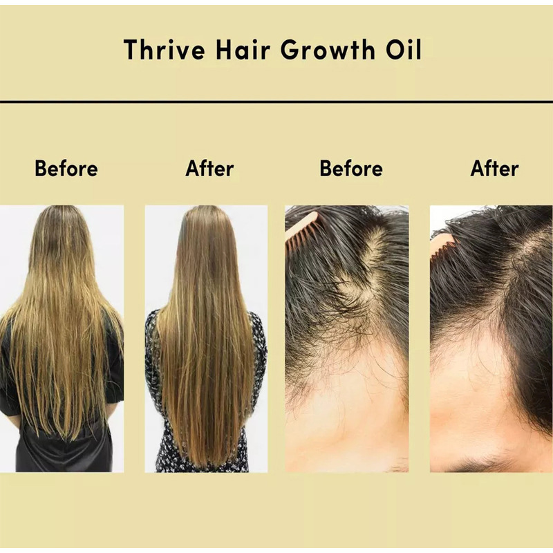 Revitalize Hair with Essential Oil: Combat Dryness, Irritability & Nourish - Image 21