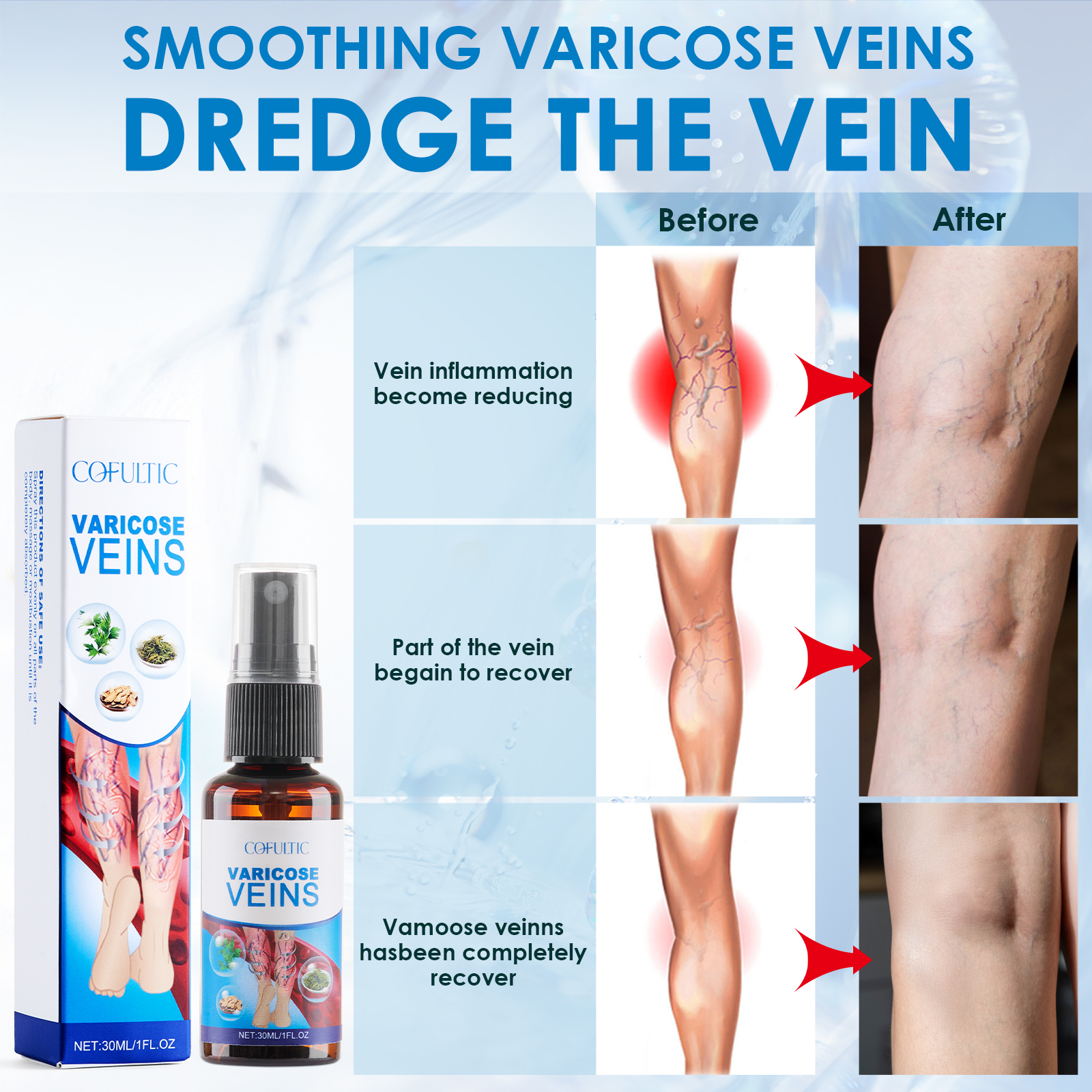 30ml Varicose Vein Spray - Multi-Purpose Knee & Leg Care to Enhance Blood Circulation - Image 3